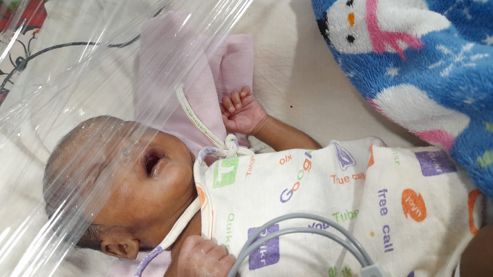 Urgent Help Needed to Save Newborn Twin Fighting for Life